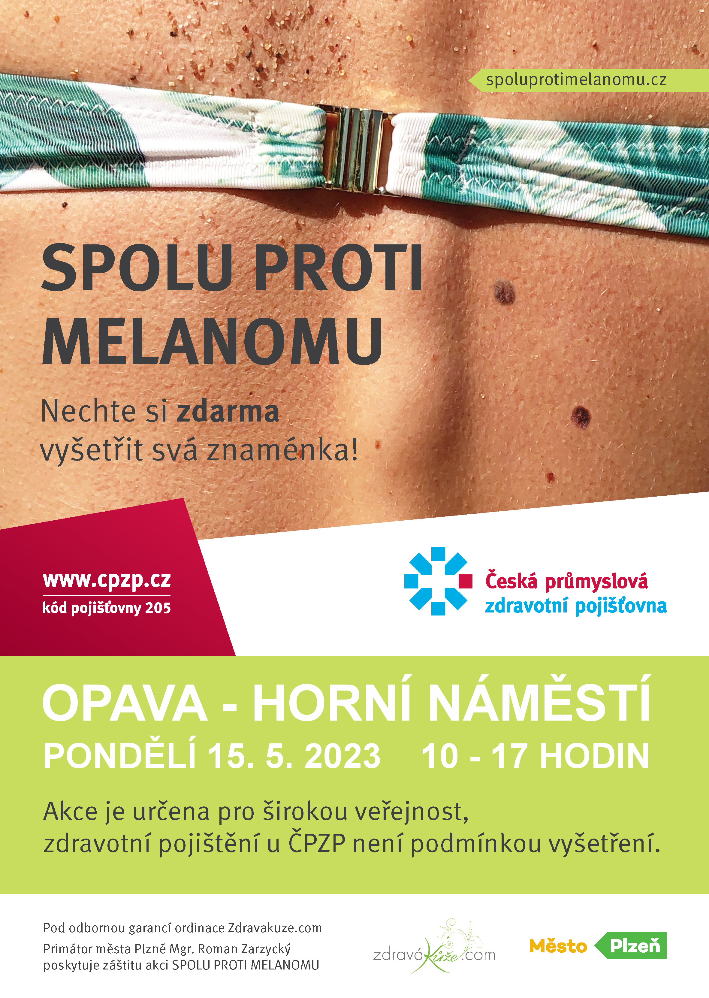 melanom | Statutární město Opava